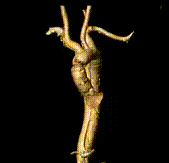 5.gif